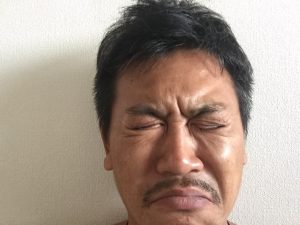 寮にあるタオルで顔を拭くだけで目が痒い
