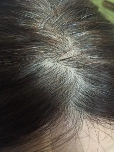 before めっちゃ白髪多いんです(´・_・`)